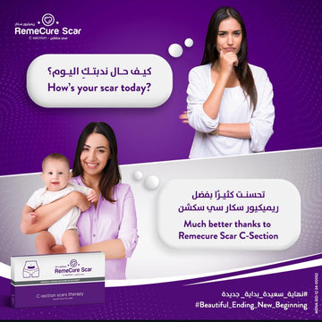 REMECURE SCAR C SECTION SCAR THERAPY 2 SHEETS